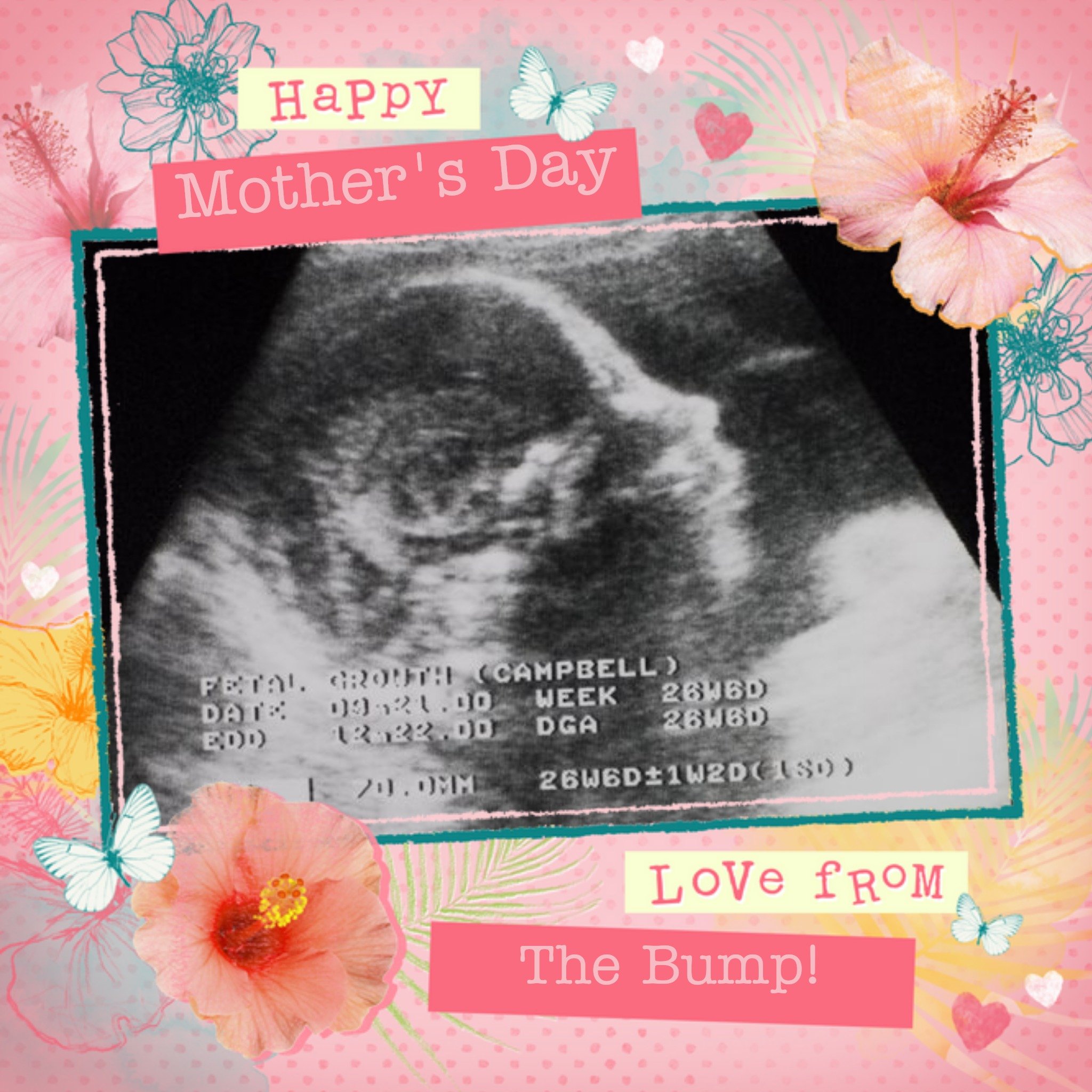 Mother's Day Card - Photo Upload Ultrasound Card - From The Bump, Square